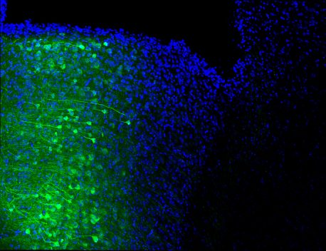 Nuclei (blue) of the medial prefrontal cortex neurons projecting their axons (green) to the periaqueductal gray area.