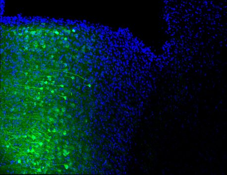 Núcleos (azul) de las neuronas de la corteza prefrontal medial que proyectan sus axones (verde) al área gris periacueductal.