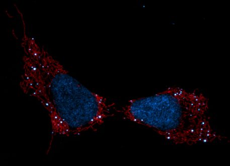 Pictured are mitochondria (red), cell nuclei (blue) and mtDNA (white dots).