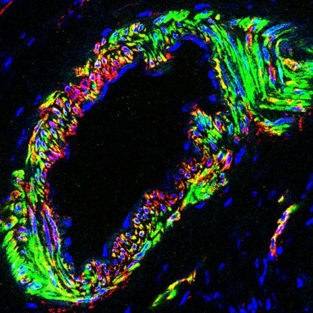 Immunofluorescence analysis of classic markers for smooth muscle cells in the ovary, including muscle filaments (green), smooth muscle proteins (red) and nuclear DNA (blue).