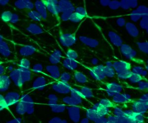 Healthy CA3 pyramidal neurons stained to show the cell body (blue) and axons (green).