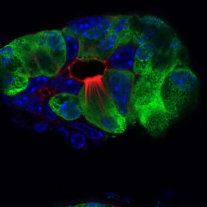 Pancreatitis tuft cells (red, microvilli and actin rootlets) in the injured pancreas (green); nuclei (blue).