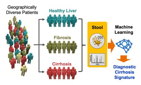 Schematic showing how the microbiome signature from stool samples can be used to test for cirrhosis.