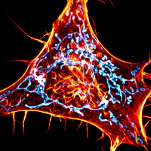 A cancer cell labeled for actin (red) and mitochondria (cyan). The scientists designed novel probes that specifically monitor interactions between actin and mitochondria