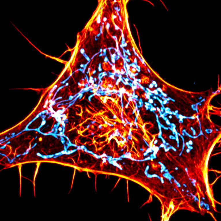 Een kankercel gelabeld voor actine (rood) en mitochondriën (cyaan). De wetenschappers ontwierpen nieuwe sondes die specifiek de interacties tussen actine en mitochondriën volgen.