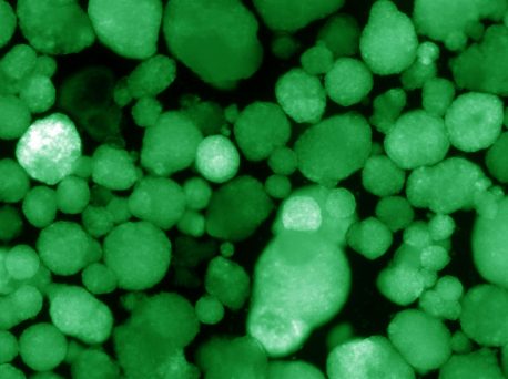 Shown here, human islet-like organoids express insulin, which is indicated by the green color.