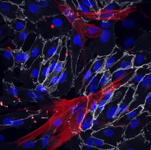 Los fibroblastos de la piel se reprogramaron con éxito en las células del músculo liso (rojas) y las células endoteliales (blancas) que rodean los vasos sanguíneos. Los núcleos de las células se muestran en azul.