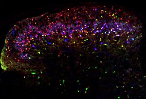 interneurons in the spinal cord