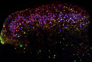 interneuronas en la medula espinal