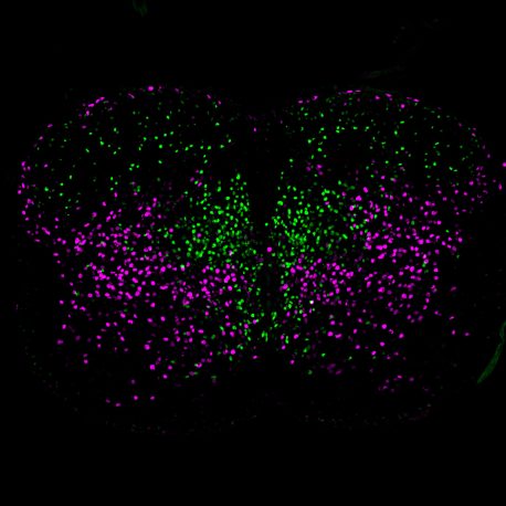 Los investigadores descubrieron un marcador genético que difería entre las neuronas de la médula espinal que solo tenían conexiones cortas (verde) y aquellas que tenían conexiones de mayor alcance (púrpura).