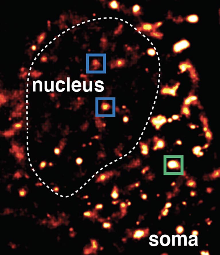 how brain cells repair their dna