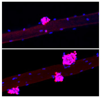 Induction of Yamanaka factors (OKSM) in muscle fibers increases the number of myogenic progenitors. Top, control; bottom, treatment. Red-pink color is Pax7, a muscle stem-cell marker. Blue indicates muscle nuclei.