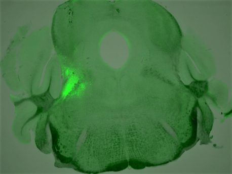 In this image of a mouse brain cross-section, a cluster of neurons that play a critical role in regulating breathing during an opioid overdose is highlighted in bright green.