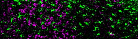 Astrocytes (green) and neurons (magenta) closely interact in the developing cortex and signal to each other to ensure correct development. 
