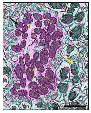 Grupos de mitocondrias de larga vida en las neuronas. Mitocondrias más viejas (flechas negras, en granate) y mitocondrias más jóvenes (flechas amarillas, en cian) que demuestran el mosaicismo de edad (envejecimiento diferencial) entre las mitocondrias en el cerebro.