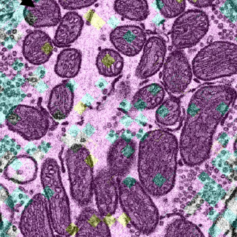 Grupos de mitocondrias de larga vida en las neuronas. Mitocondrias más viejas (flechas negras, en granate) y mitocondrias más jóvenes (flechas amarillas, en cian) que demuestran el mosaicismo de edad (envejecimiento diferencial) entre las mitocondrias en el cerebro.