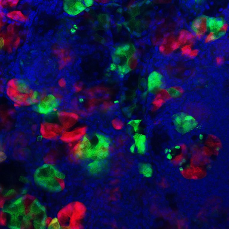 Las células acinares pancreáticas forman una población diversa de nuevos tipos de células en respuesta a una lesión con el potencial de limitar o impulsar la enfermedad. Clones derivados de acinares marcados en rojo y verde.