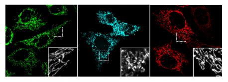 Healthy mitochondria (green); mitochondria showing the effects of oxidative stress (blue); and oxidative stress with CBN (red). Insets show higher magnification of the structure of the mitochondria