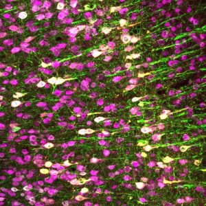 Neurons (magenta) in the mouse brain. The Chalasani lab made specific neurons express TRPA1 (white), so they can be activated by ultrasound.