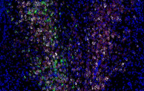 Expresión de varios genes y proteínas (blanco, rojo y verde) en neuronas entre células cerebrales de ratón (azul).