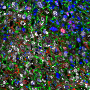 Las células hepáticas se reprogramaron parcialmente en células más jóvenes (rojas) usando factores de Yamanaka (blanco). También se muestran los núcleos celulares (azul) y las proteínas del citoesqueleto (verde).