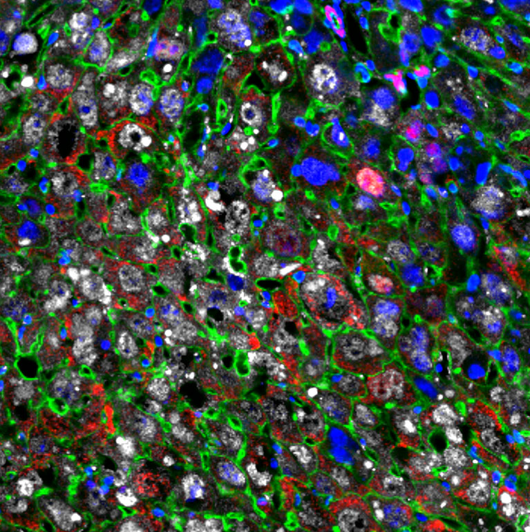 Liver cells were partially reprogrammed into younger cells (red) using Yamanaka factors (white). The cell nuclei (blue) and cytoskeletal proteins (green) are also shown.