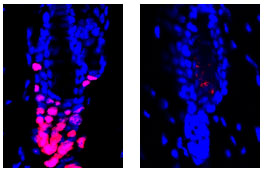  Glucocorticoid hormone signal in regulatory T cells promotes hair follicle stem cell activation and new hair growth. Left: After hair loss, skin cells (blue) from a normal mouse can activate hair follicle stem cells (red). Right: Cells from mice without glucocorticoid receptors in their regulatory T cells cannot activate hair follicle stem cells. 