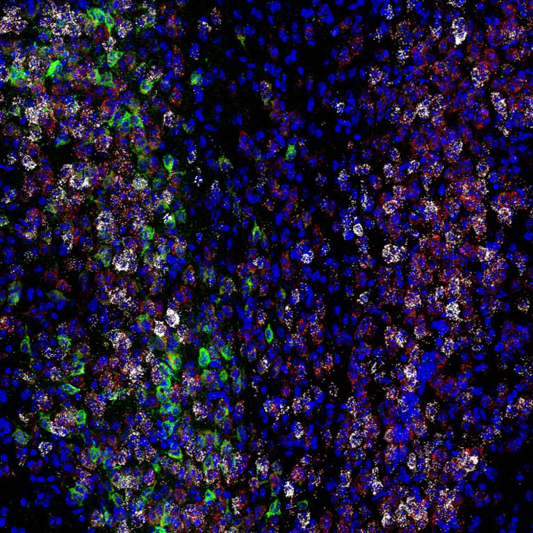 Expression of various genes and proteins (white, red, and green) in neurons amongst mouse brain cells (blue).
