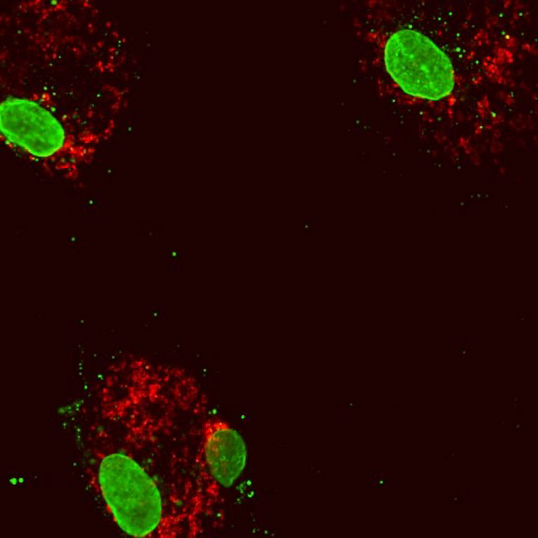 Human blood cells following reduced expression of the gene DNMT3A. The cell nuclei (large green structures) inside the cytoplasmic protein (red). Some mitochondrial DNA (small green dots) has escaped into the cytoplasm, inducing an inflammatory response.
