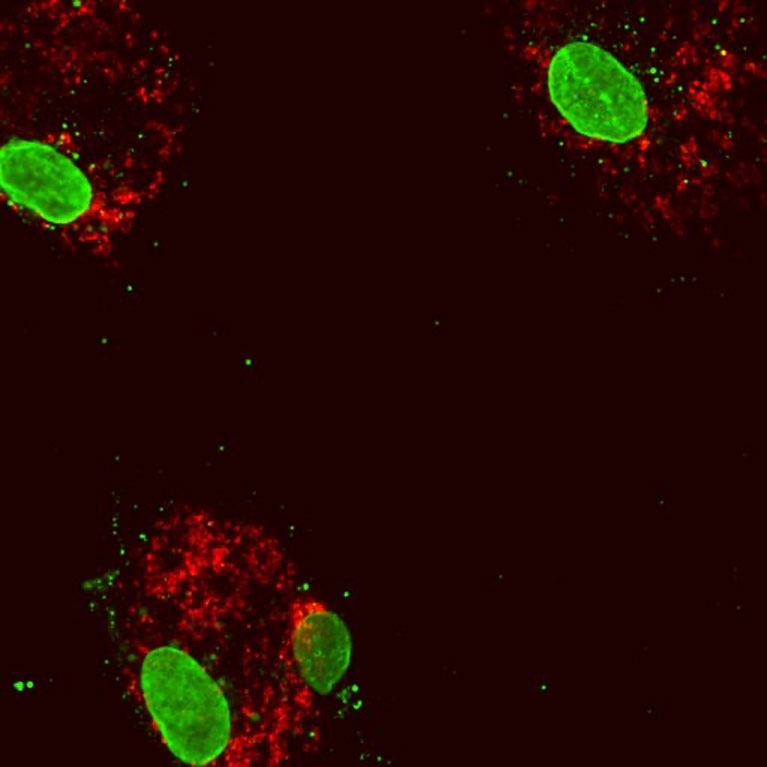 Menselijke bloedcellen na verminderde expressie van het gen DNMT3A. De celkernen (grote groene structuren) in het cytoplasmatische eiwit (rood). Er is wat mitochondriaal DNA (kleine groene stippen) ontsnapt in het cytoplasma, wat een ontstekingsreactie veroorzaakt.