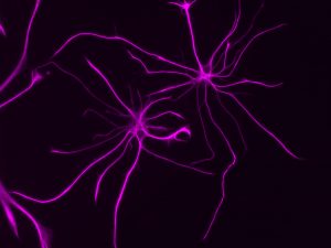Salk researchers studied the molecules produced by astrocytes, like those pictured, to understand how the cells play a role in neurodevelopmental disorders. 