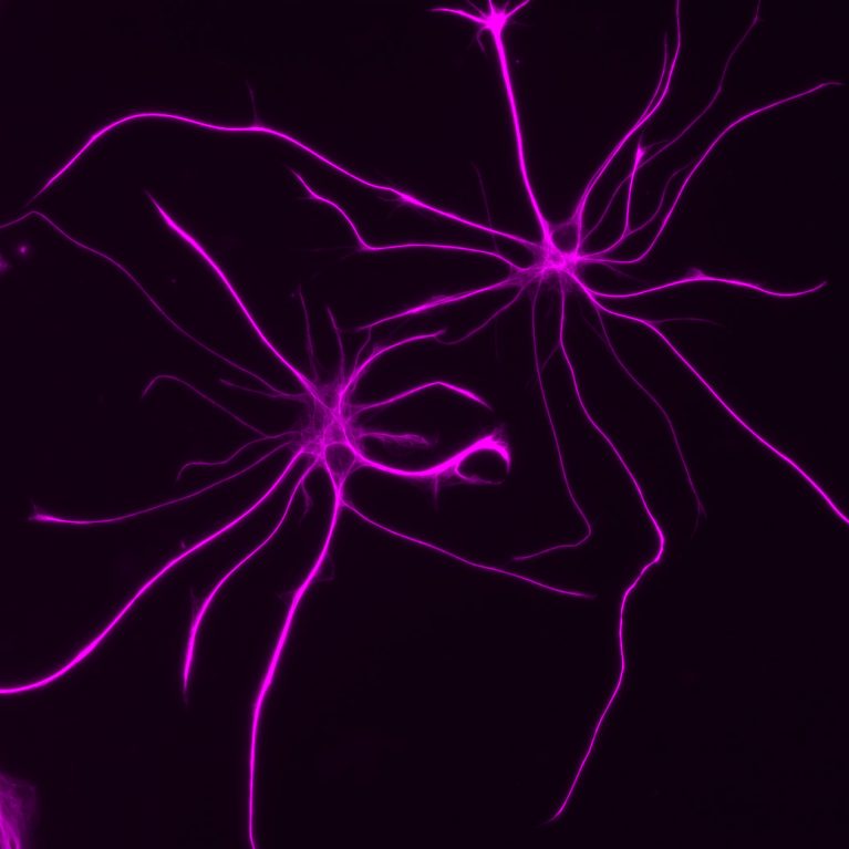 Salk researchers studied the molecules produced by astrocytes, like those pictured, to understand how the cells play a role in neurodevelopmental disorders.