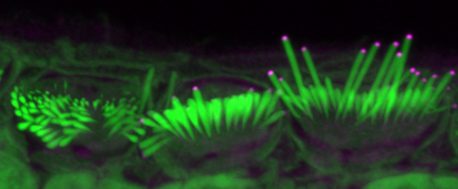 From left: Short, intermediate and long hair stereocilia (green) of the inner ear that transduce sound in mice treated with increasing levels of EPS8 (magenta). The addition of more EPS8 results in stereocilia elongation.