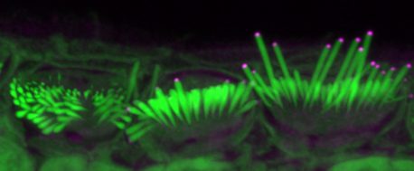 Desde la izquierda: estereocilios de pelo corto, intermedio y largo (verde) del oído interno que transducen el sonido en ratones tratados con niveles crecientes de EPS8 (magenta). La adición de más EPS8 da como resultado el alargamiento de los estereocilios.