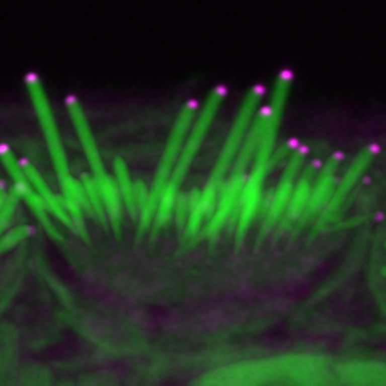 From left: Short, intermediate and long hair stereocilia (green) of the inner ear that transduce sound in mice treated with increasing levels of EPS8 (magenta). The addition of more EPS8 results in stereocilia elongation.