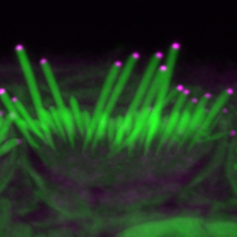 Van links: stereocilia met kort, halflang en lang haar (groen) van het binnenoor die geluid transduceren bij muizen die zijn behandeld met toenemende niveaus van EPS8 (magenta). De toevoeging van meer EPS8 resulteert in stereociliaverlenging.