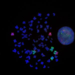 Cuando las mutaciones genéticas hacen que los cromosomas se separen y fusionen de diferentes maneras, las células normales pueden volverse cancerosas. En esta imagen, los cromosomas normales (azul) se muestran con cromosomas (verde y rojo) que han sido alterados mediante ingeniería genómica CRISPR-Cas9 y fusionados nuevamente. Haga clic aquí para obtener una imagen de alta resolución. Crédito: Instituto Salk