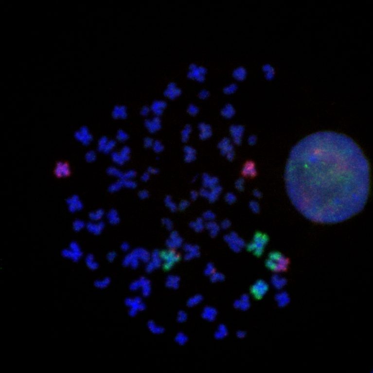 Cuando las mutaciones genéticas hacen que los cromosomas se separen y fusionen de diferentes maneras, las células normales pueden volverse cancerosas. En esta imagen, los cromosomas normales (azul) se muestran con cromosomas (verde y rojo) que han sido alterados mediante ingeniería genómica CRISPR-Cas9 y fusionados nuevamente.