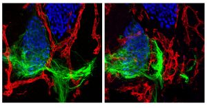 In the image on the left, motor neurons (green) clear a path through blood vessels (red) as they grow toward muscles in developing healthy mice. On the right, this process is disrupted in mice where genetic mutation prevents the blood vessels from detecting signals that tell them to move out of the way. 