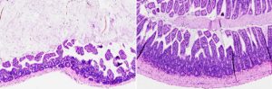 Salk researchers discovered the compound FexD can treat intestinal inflammation in mice. Mice with symptoms similar to inflammatory bowel disease had changes to the cells lining their intestines (left) that were reversed with treatment (right).