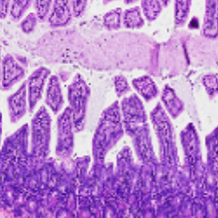 Salk researchers discovered the compound FexD can treat intestinal inflammation in mice. Mice with symptoms similar to inflammatory bowel disease had changes to the cells lining their intestines (left) that were reversed with treatment (right).