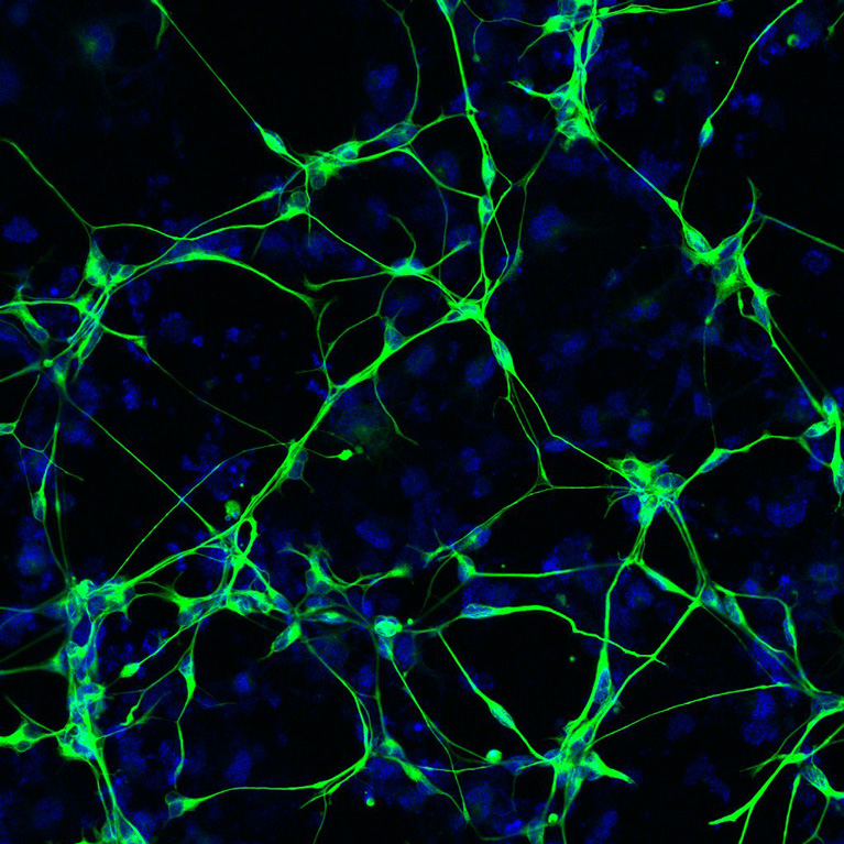 Neurons (green) derived from a patient with Alzheimer’s disease. The nuclei (blue) of the neurons are also shown.