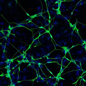 Neurons (green) derived from a patient with Alzheimer's disease. The nuclei (blue) of the neurons are also shown.