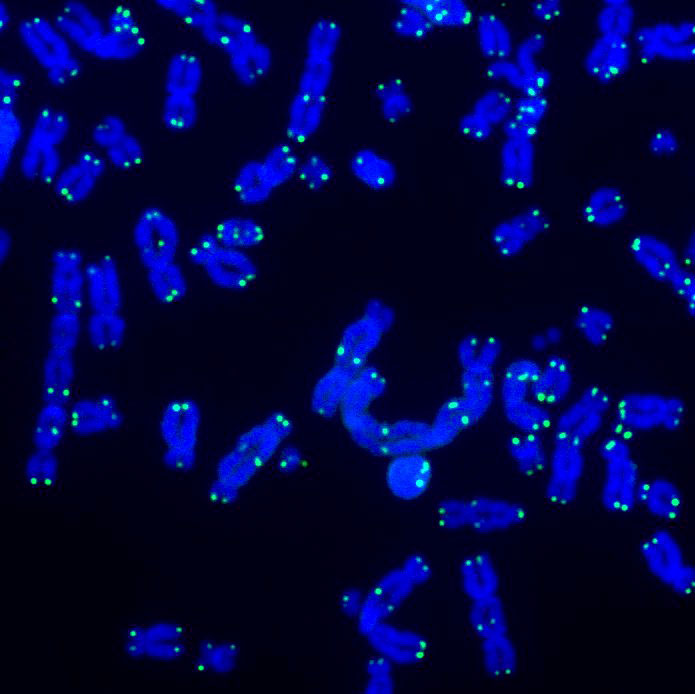 Telomeres protect the ends of chromosomes from damage. This image shows telomeres (green) and DNA (blue) during DNA repair activities.