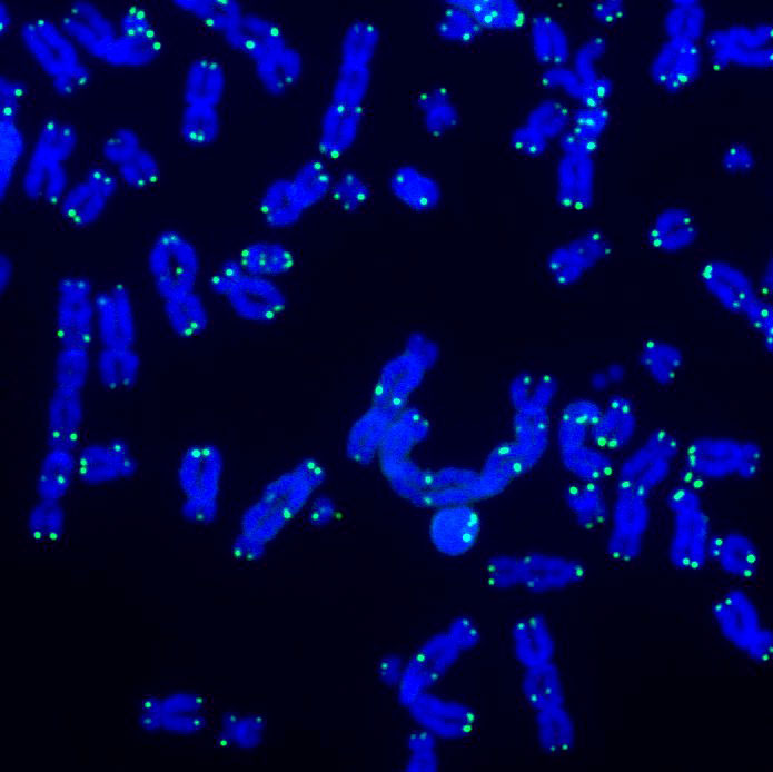 Los telómeros protegen los extremos de los cromosomas del daño. Esta imagen muestra los telómeros (verde) y el ADN (azul) durante las actividades de reparación del ADN.