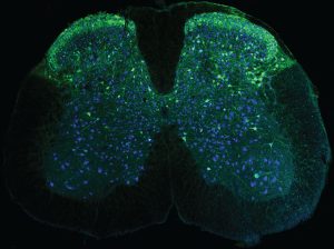 Neurons in the spinal cord (blue), including those that send signals about pain (green), captured using one of the new wearable microscopes. 