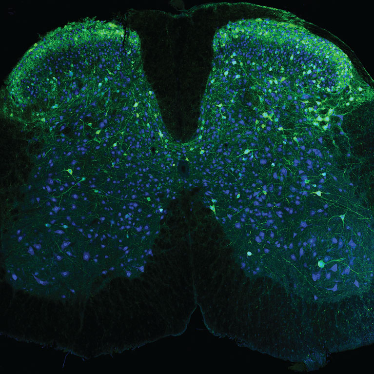 Neurons in the spinal cord (blue), including those that send signals about pain (green), captured using one of the new wearable microscopes.