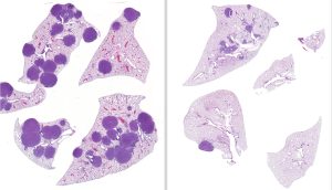 Izquierda: tejido pulmonar de ratones con cáncer de pulmón de células no pequeñas mutado en LKB1. Derecha: tejido pulmonar después de ser tratado con trametinib y entinostat que muestra tumores más pequeños y menos.