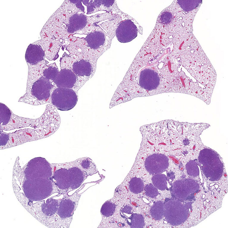 Lung tissue of mice with LKB1-mutated non-small cell lung cancer.