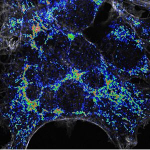 Mitochondriën in de cel tijdens metabole stress. Hoge toenames in het aantal mitochondriën (rood), gemiddelde toenames (groen) en lage toenames (blauw).